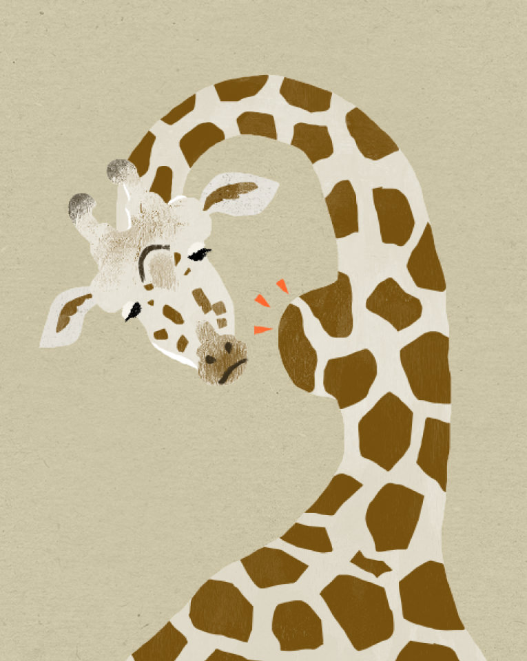 粉瘤のイラスト